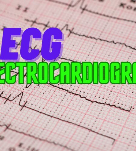 What is the Importance of an Electrocardiogram?
