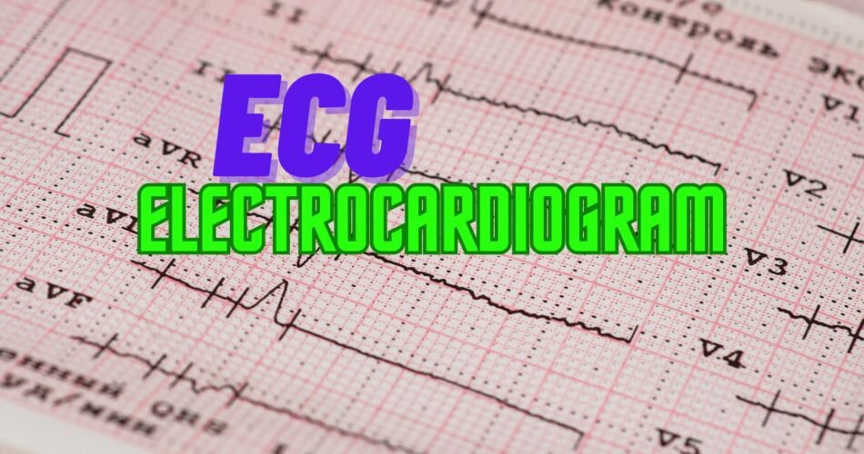 Electrocardiogram