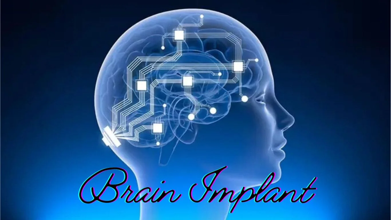 Brain Implant