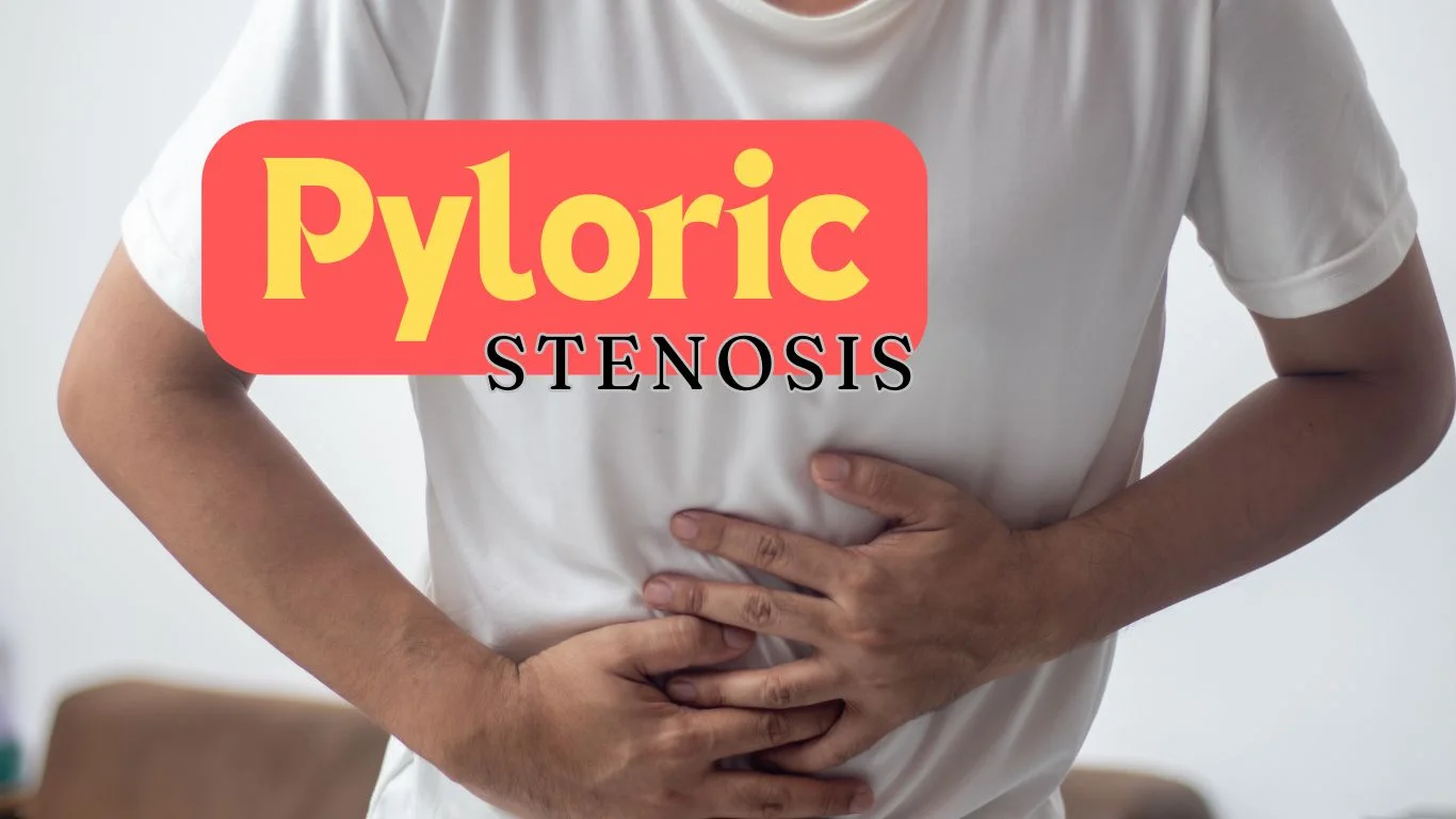 Pyloric Stenosis